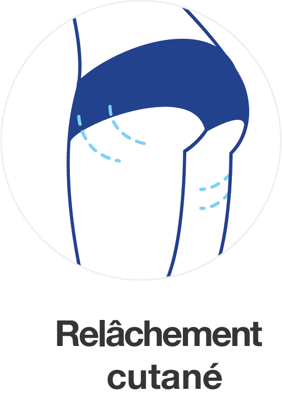 Relachement cutane